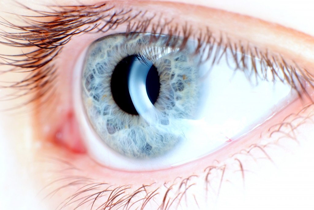tratamientos oftalmológicos Anillos_corneales