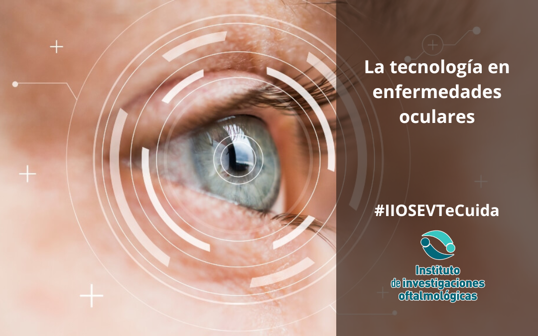El impacto de la tecnología en el diagnóstico y tratamiento de enfermedades oculares
